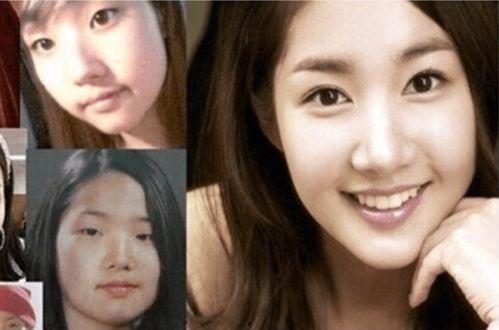 明星需要整容吗,美丽背后的真相与选择