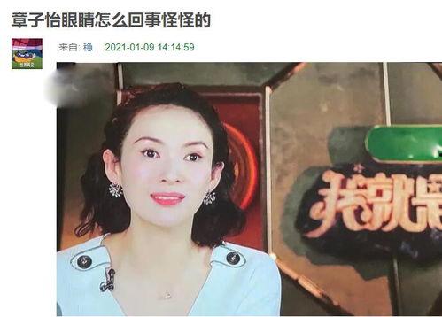 斗鸡眼严重的明星,揭秘其独特魅力背后的故事